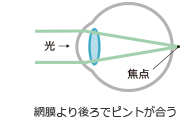 網膜より後ろでピントが合う